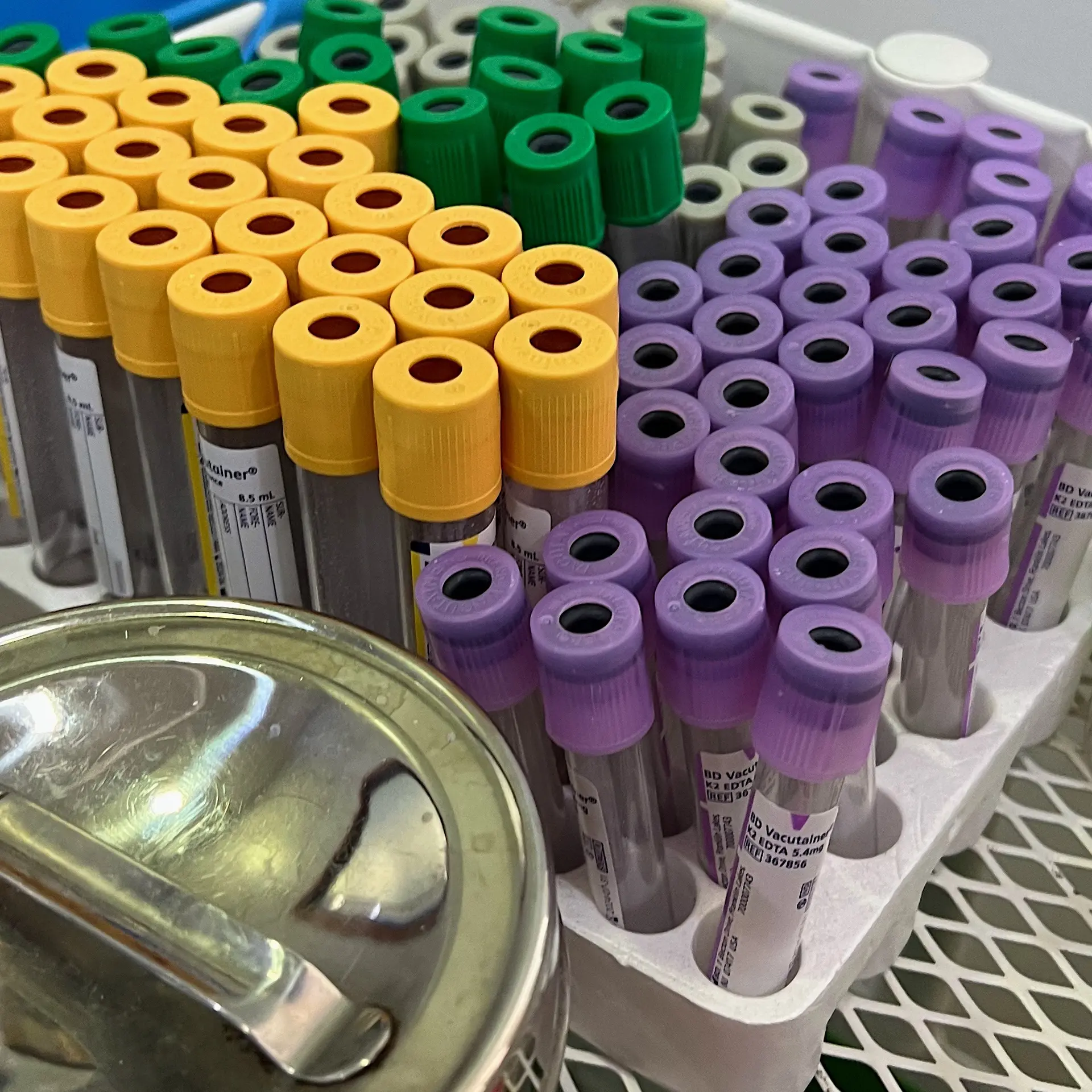 Image for Modified Glucose Tolerance Test (MGTT)