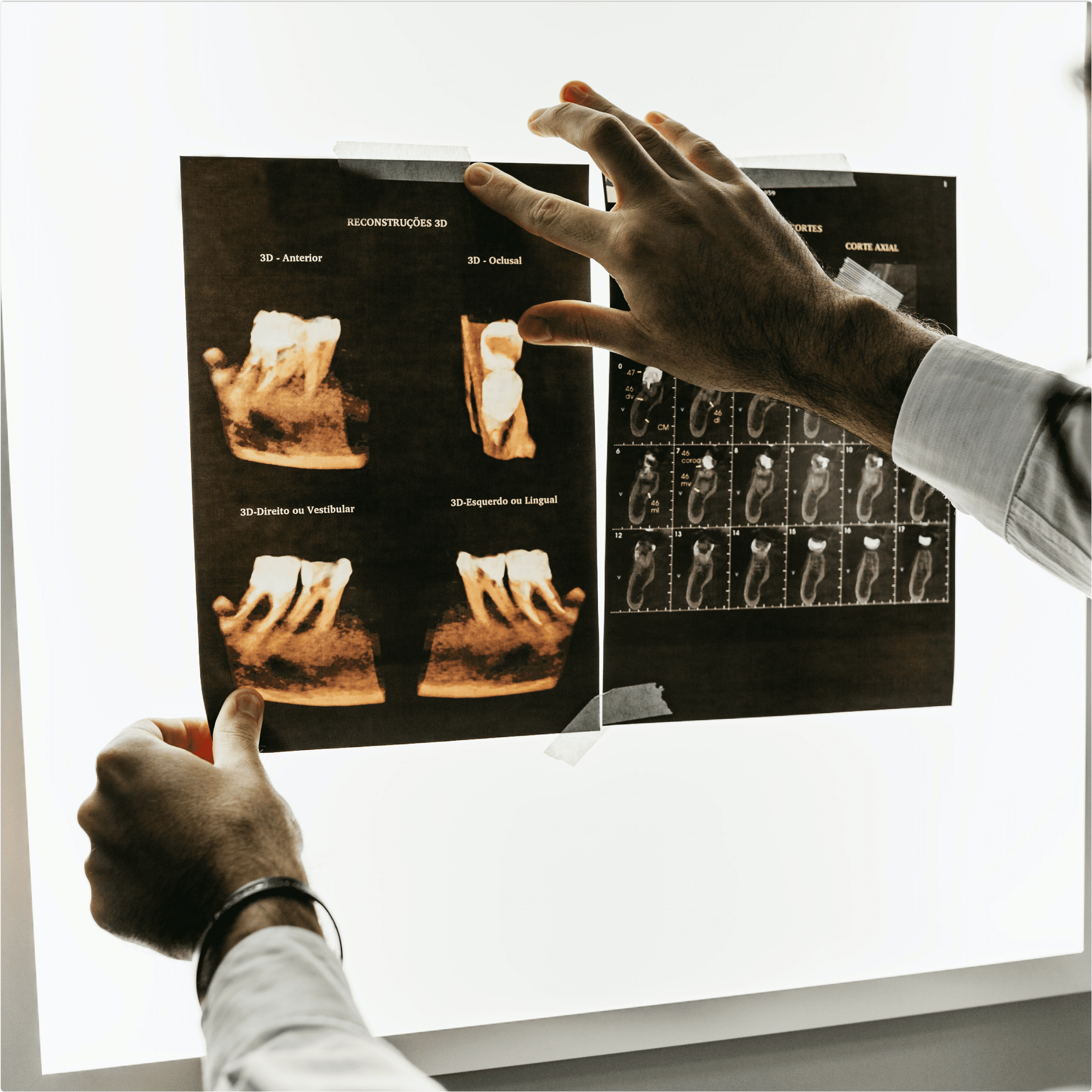 A doctor pointing to an X-ray image displayed on a light board.